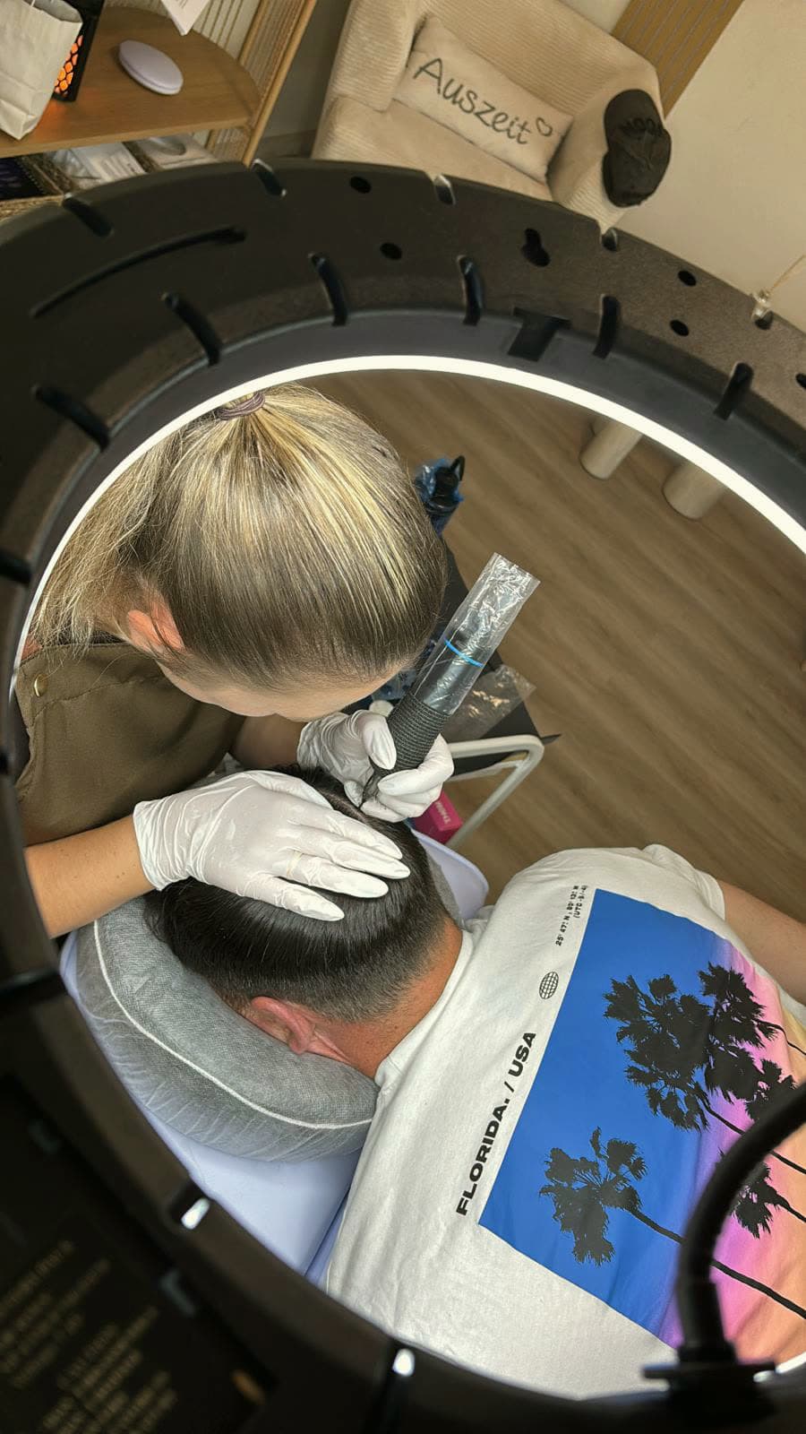 Olga bei einer Kopfhautpigmentierung — Behandlung unter dem Ringlicht im Studio